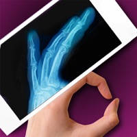 Simulator X-Ray – Finger Prank Simulator X-Ray – Finger Prank