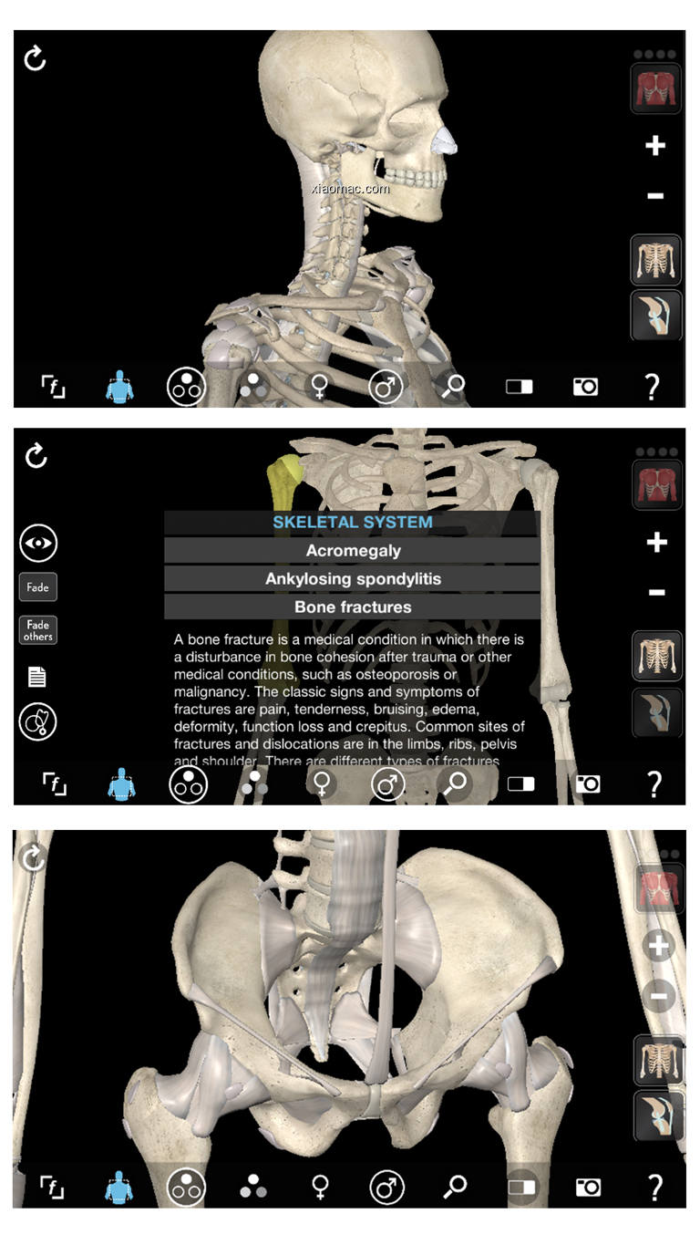 【图】3D Organon Anatomy – Skeleton, Bones, and Ligaments(截图 0)