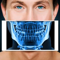 Xray Scanner Teeth Prank Xray Scanner Teeth Prank