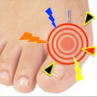 Gout Diagnosis