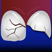 ToothSOS ToothSOS