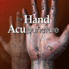 Hand Acupuncture