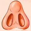 IPO Rinoplastia RA