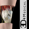 Knee Pro III with Animations Knee Pro III with Animations