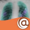 COPD @Point of Care™