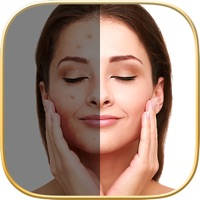 Blemish Editor – Pimple Eraser