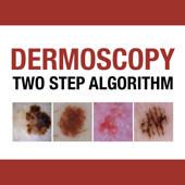 Dermoscopy Two Step Algorithm